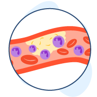Gangguan Platelet