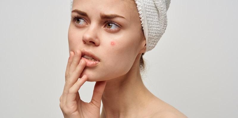 Jerawat Selalu Muncul Pada Kawasan Pipi? Cuba Ingat Balik, Ada Tak Anda Lakukan Perkara Ini?