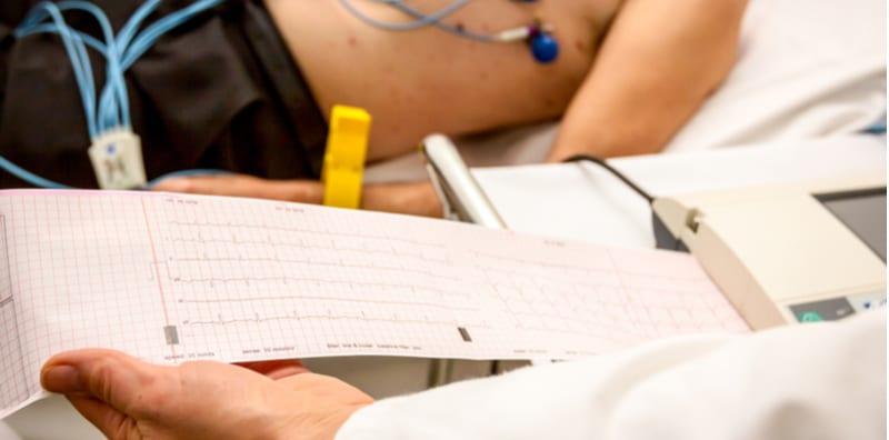 Apa Itu ECG? Fahami Kegunaan Mesin Pengesan Ritma Dalam Pengurusan Penyakit Jantung