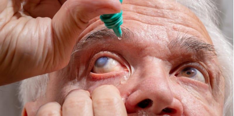 penglihatan-kabur-katarak