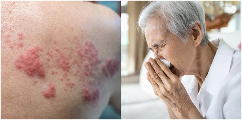 contoh-penyakit-berjangkit