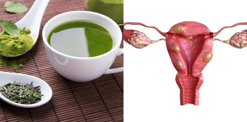 Cegah Fibroid Rahim Dengan Ubah Gaya Hidup & Pemakanan Sihat