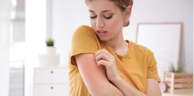 Info Lengkap Alahan Pada Kulit