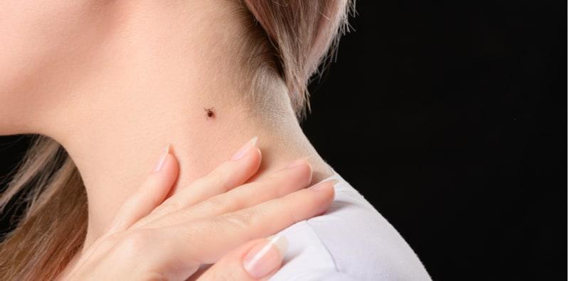 gigitan-kutu-zoonoses