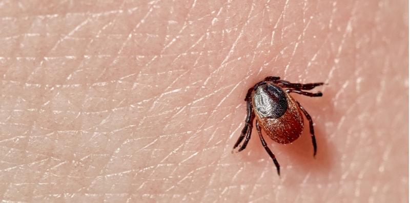 gigitan-kutu-lyme