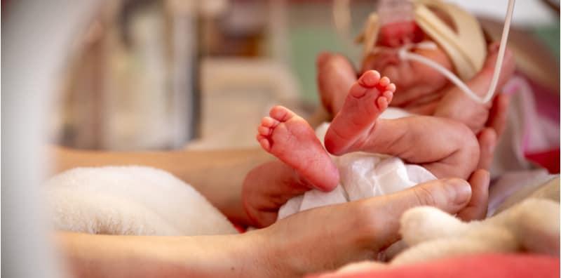 Selain Saiz Kecil, Ini 5 Perbezaan Fizikal Bayi Pramatang Perlu Difahami