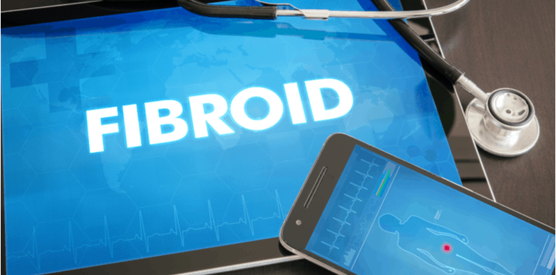 rawatan-fibroid-tanpa-pembedahan
