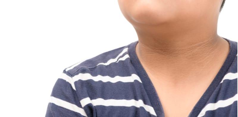 kulit-menebal-dan-hitam