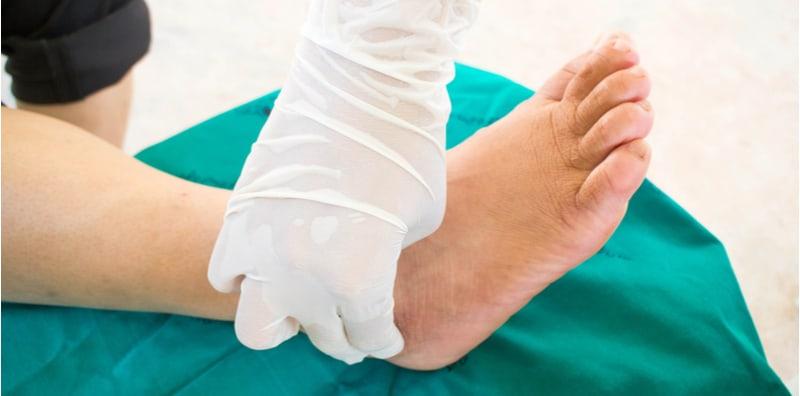 Orang Sakit Diabetes Bukan Saja Kena Potong Kaki, Tapi Ada Masalah Kaki Lain Yang Lebih Kronik!