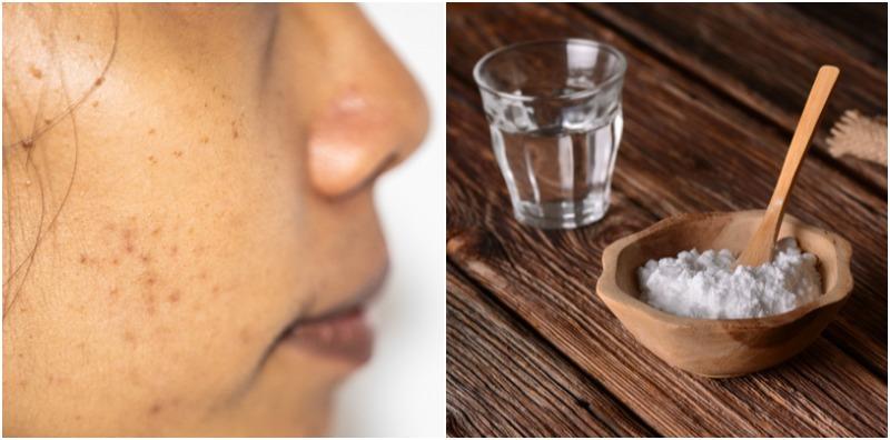 5 Petua Hilangkan Jeragat Dengan Baking Soda, Jom Cuba!