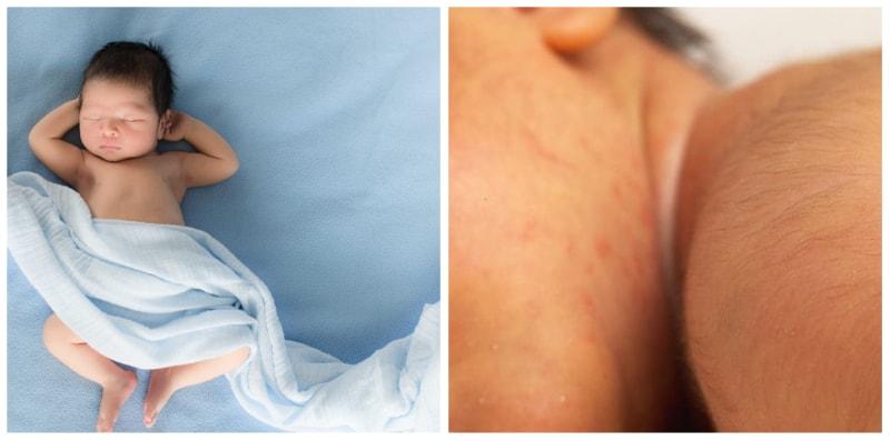 keadaan-bayi-pelik-tapi-normal