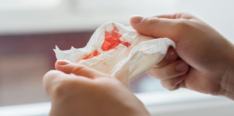 Batuk Berdarah, Benarkah Ia Tanda Kanser Paru-Paru Kronik?