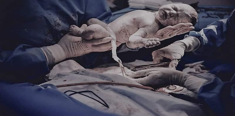 darah-tali-pusat-bayi