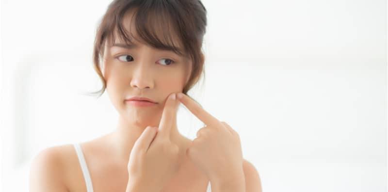 punca-naik-jerawat-jatuh-cinta