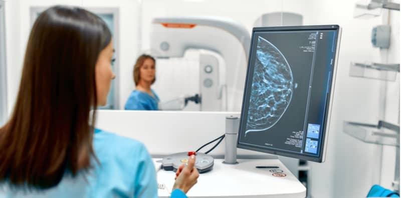 Berapa Usia Yang Sesuai Untuk Lakukan Pemeriksaan Mamogram?