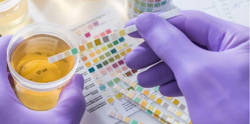 warna-urin-tidak-normal