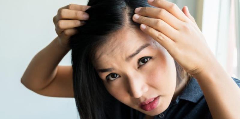 sebab-rambut-gugur-diabetes