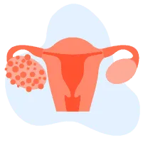 Ujian Risiko Kanser Ovari