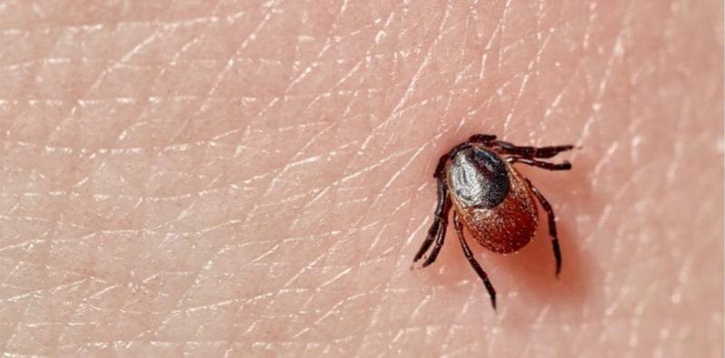 Awas, Ini 3 Jenis Penyakit Jangkitan Kulit Yang Disebabkan Oleh 'Makhluk Asing'!