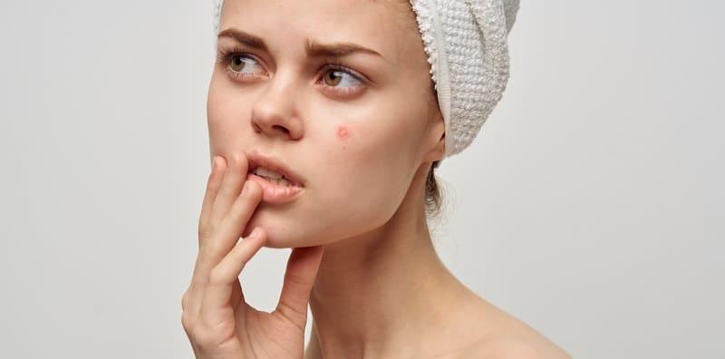 cara-cuci-muka-jerawat