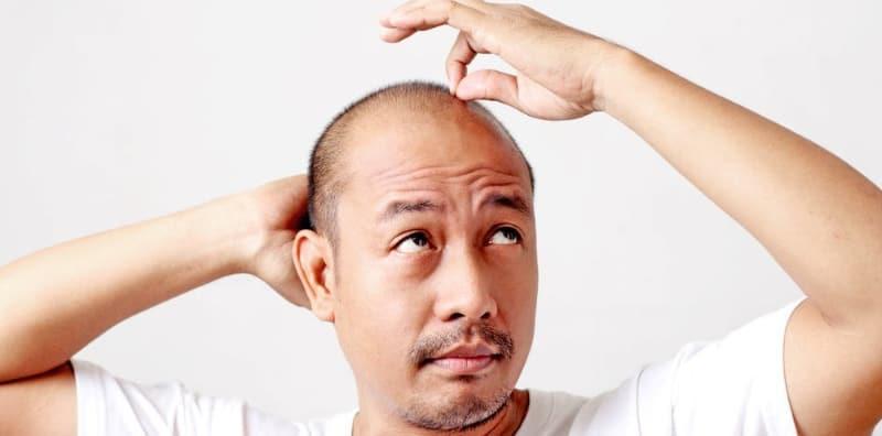 akibat-stress-rambut