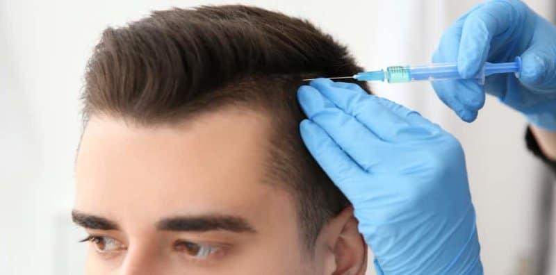 Kalau Tak Nak Botak, Boleh Cuba Rawatan Untuk Tanam Rambut, Berkesankah?