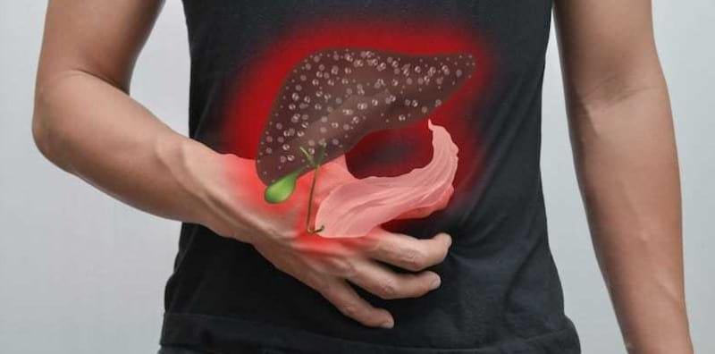 Hepatitis B