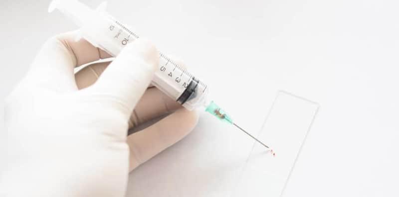 Jangan Tunggu Dah Sakit, Ini 9 Jenis Ujian Kanser Orang Muda Kena Jalani!