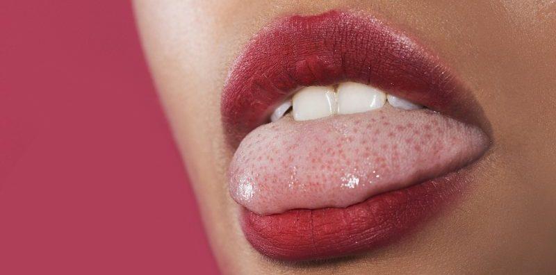 Warna Lidah Normal Merah Jambu? Ini Cara Nak Tahu Kesihatan Lidah