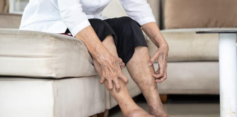 Ada Tompok Merah Kecoklatan Pada Kaki? Ini Sebab Dermopati Diabetik