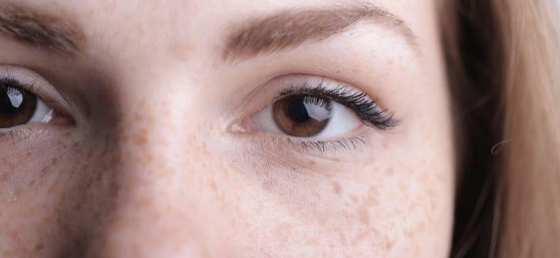 Cari Cara Hilangkan Jeragat Secara Tradisional? Mudah Saja, Gunakan Lemon!