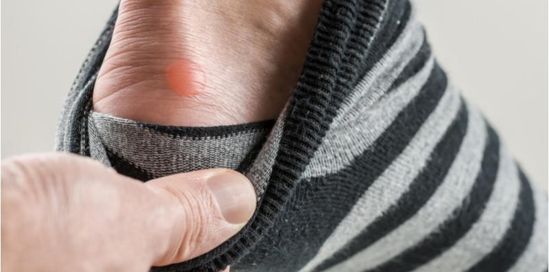 Aduh, Sakitnya Ada Gelembung Air Di Kaki! Cuba Rawat Dengan 13 Tip Ini