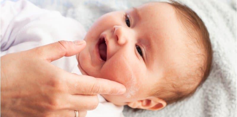 Kulit Anak Naik Ekzema Masa Bulan Puasa? Cuba 5 Produk Popular Untuk Baby Eczema