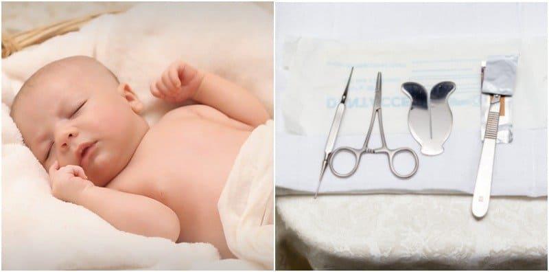 Bila Waktu Sesuai Sunat Anak Lelaki, Ketika Bayi Atau Tunggu Besar Sikit?