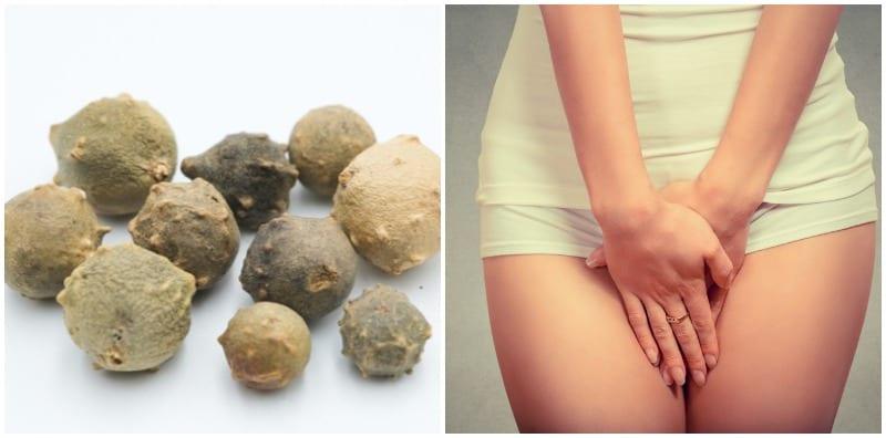 cara-mengetatkan-faraj-menggunakan-manjakani