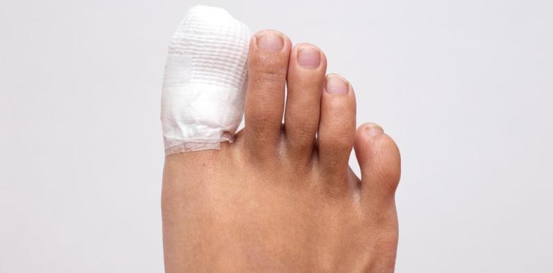 Kuku Kaki Cengkam? Ini Dia 10 Punca Serta 5 Cara Untuk Rawat Cagu!