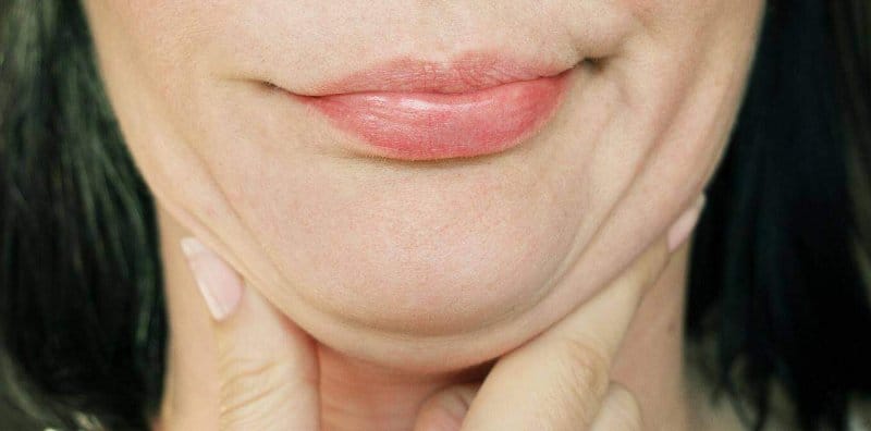 Risau Muka Makin Membulat Lepas Raya? Ini 7 Cara Dapatkan Wajah V Shape TANPA Bedah!