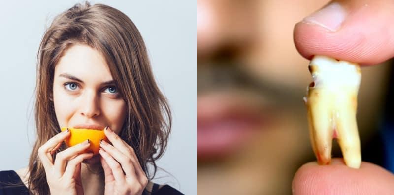 makanan-yang-tidak-baik-untuk-gigi