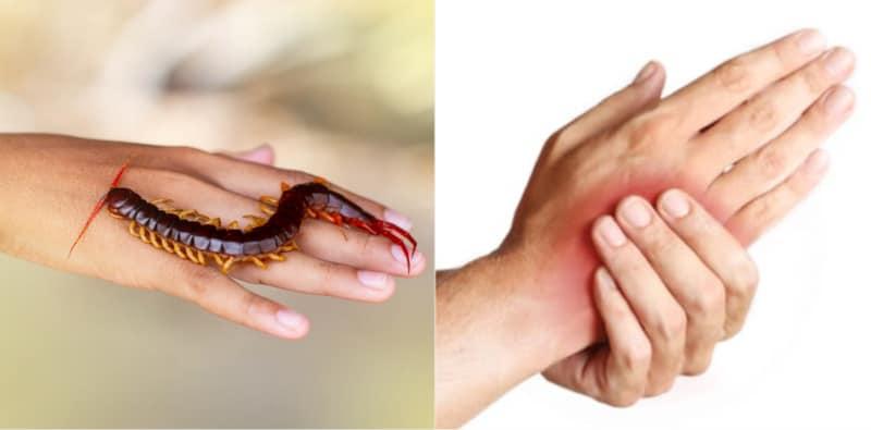 Kesan Gigitan Lipan Boleh Bawa Maut? Ini 7 Langkah Penting Untuk Rawat Di Rumah!