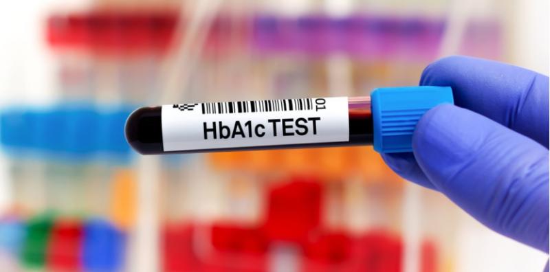 Carta Kencing Manis Untuk Pesakit Diabetes, Ini 3 Jenis Ujian Bantu Uruskan Diabetes!