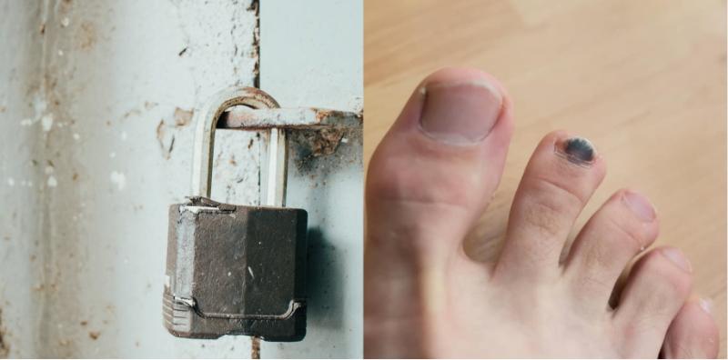 kuku-hitam-tanda-penyakit-apa