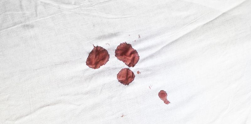 Hapuskan Stigma Tak Berdarah Di Malam Pertama Tanda Tiada Dara! Ini Fakta Sebenar