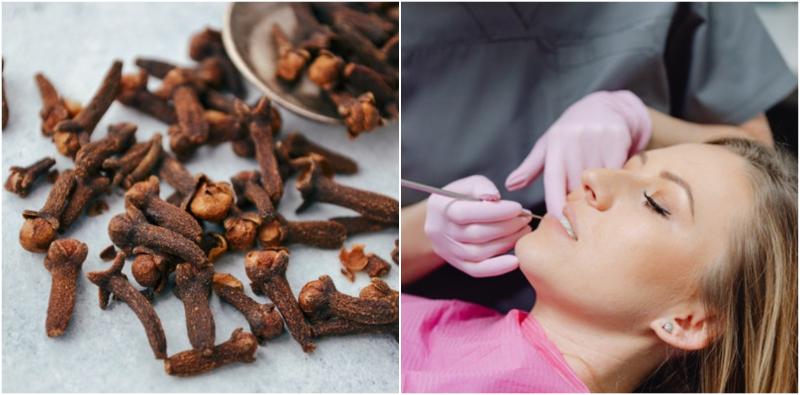 cara-hilangkan-sakit-gigi-berlubang