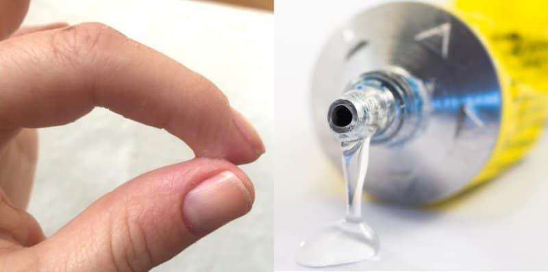 gam-gajah-terlekat-kulit