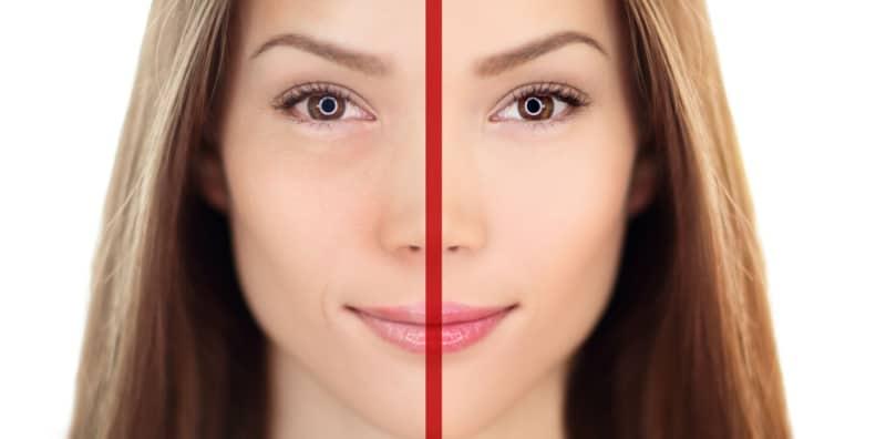 8 Cara Cepat Hilangkan Eyebag Dari Pakar Profesional, No. 2 Wajib Buat Kalau Tak Nak Mata Panda!