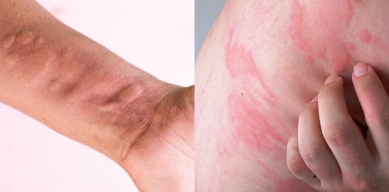 pantang-larang-sopak-garam