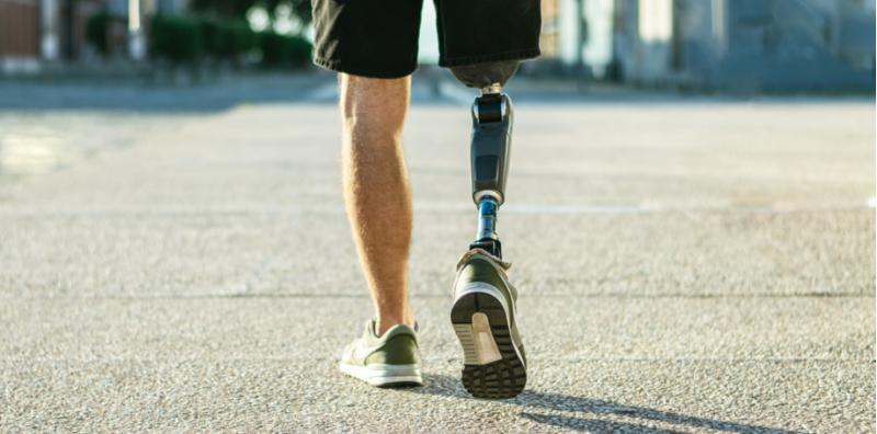 potong-tangan-phantom-pain